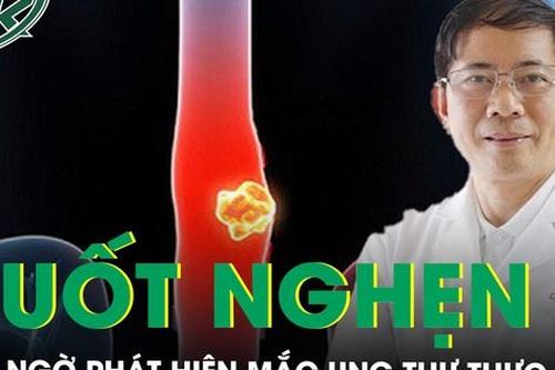 Khó ăn, nuốt nghẹn đi khám phát hiện ung thư thực quản