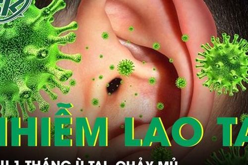 Ù tai, chảy mủ, khàn tiếng hơn 1 tháng không ngờ nhiễm lao ở tai