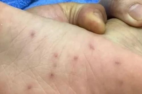 Cơ quan chức năng vào cuộc vụ trẻ em nghi bị bạo hành ở Bình Định