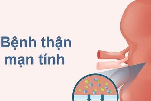 4 cách ngăn chặn bệnh thận mạn tiến triển thành suy thận