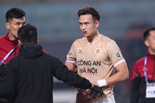 'Trung vệ thép' của ĐT Việt Nam nhập viện sau pha va chạm mạnh, khiến HLV Troussier lo sốt vó