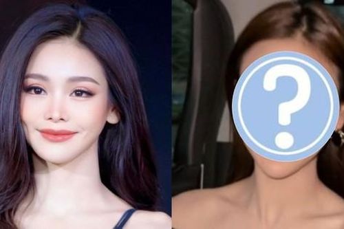 Không thể nhận ra Hoa hậu hòa bình với chiếc cằm biến dạng nhọn hoắt, gương mặt như búp bê sao đáng sợ quá