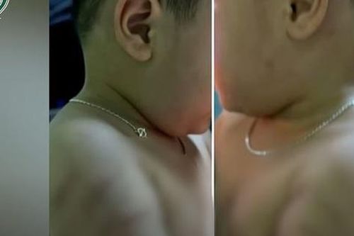 Sáng 9/3: Đình chỉ công tác giáo viên mầm non 'vịn tay' bé trai sinh năm 2021 bầm tím