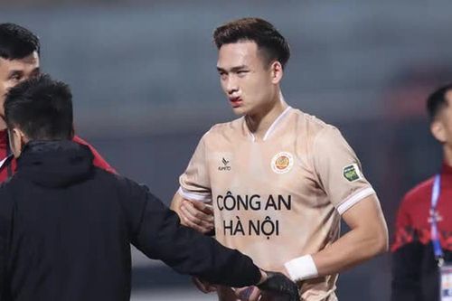 Bùi Hoàng Việt Anh mất ngủ sau chấn thương, bỏ ngỏ khả năng ra sân trận gặp Indonesia