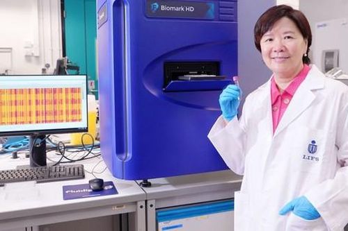 Phương pháp xét nghiệm máu phát hiện sớm bệnh Alzheimer