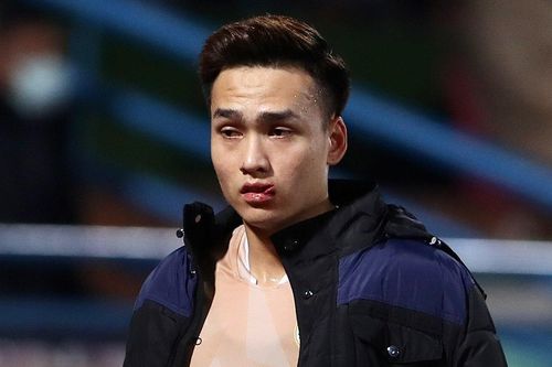 Bùi Hoàng Việt Anh khâu 24 mũi