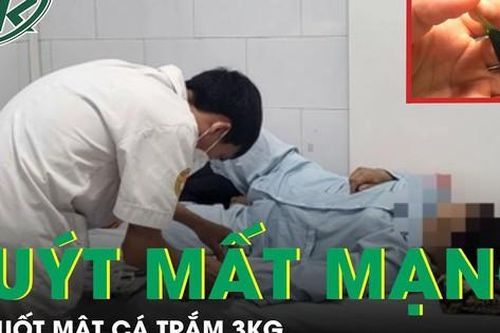 Người phụ nữ suýt mất mạng vì nuốt mật cá trắm 3kg