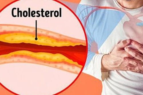 4 loại thực phẩm tốt nhất giúp giảm mức cholesterol