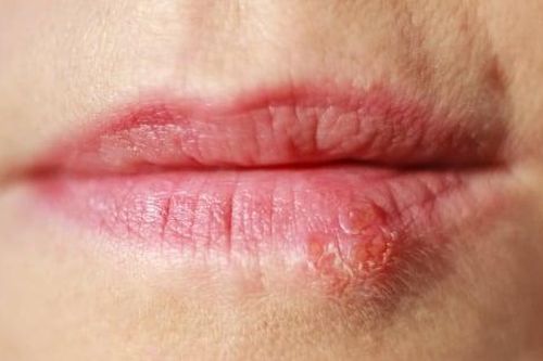 Chưa kịp mừng vì mỹ phẩm 'xịn' giá bình dân đã phải vội gặp bác sĩ