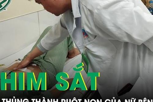 Gắp chiếc ghim sắt đâm thủng thành ruột non của nữ bệnh nhân