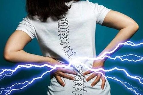 Đau lưng do thoát vị đĩa đệm, cần hạn chế ăn gì để phòng tránh cơn đau?