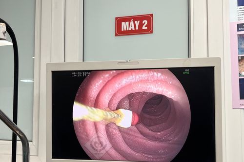 Lấy kim diệt tủy răng trong bụng bé 8 tuổi