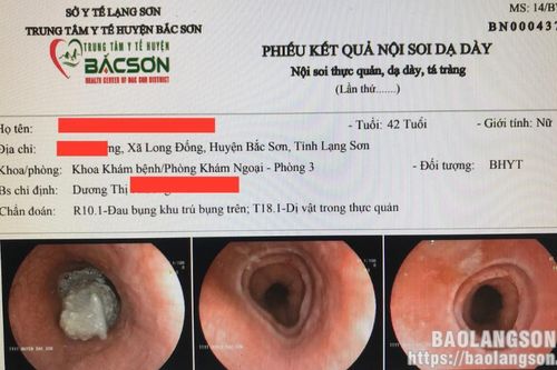 Trung tâm y tế huyện Bắc Sơn cấp cứu thành công bệnh nhân bị hóc thức ăn
