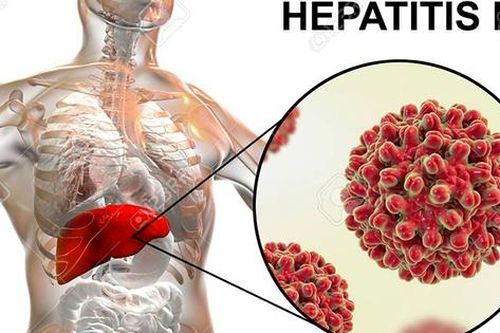 Đau bụng, người đàn ông 38 tuổi đi khám phát hiện có khối u gan 'khủng', đây có thể là nguyên nhân