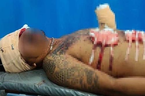 Một người trọng thương nghi do dùng thuốc nổ đánh cá
