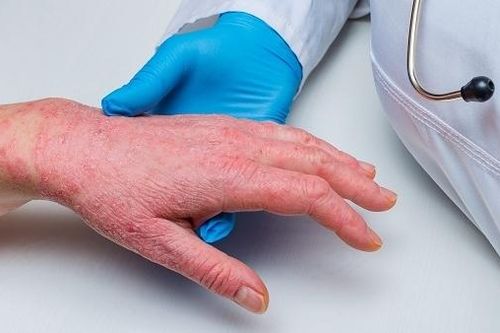 Thời tiết nồm ẩm, gia tăng người mắc bệnh về da liễu