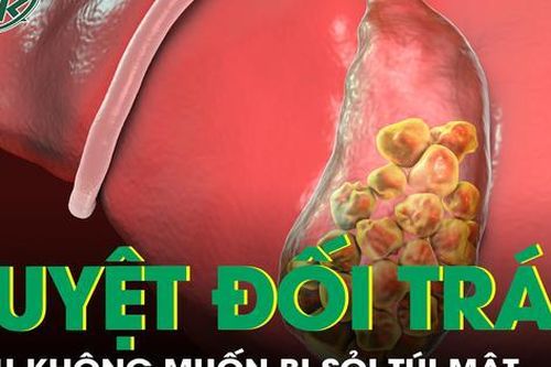 Tuyệt đối tránh điều này nếu không muốn bị sỏi túi mật