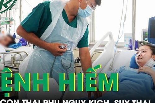 Cứu thai phụ bị thoát vị hoành bẩm sinh hiếm gặp