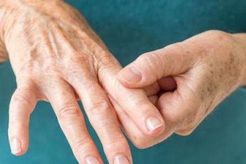 Những triệu chứng nguy hiểm của viêm khớp dạng thấp