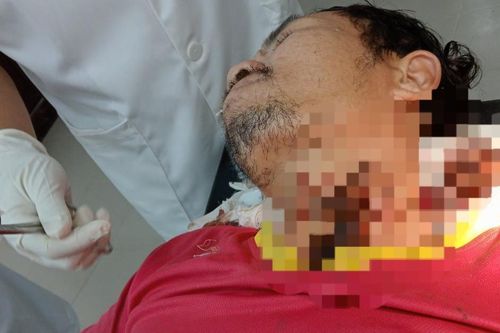 Người đàn ông bị mảnh thép cắt vào cổ khi đang đánh bắt trên biển
