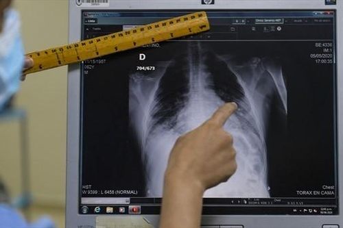 Các bác sĩ X-quang tại Nga có cơ hội sử dụng AI để xác định 54 loại bệnh