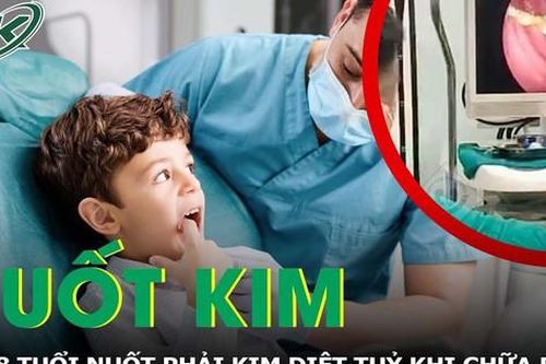Trẻ 8 tuổi nuốt phải kim diệt tủy khi đi chữa răng