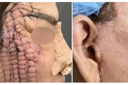 Nữ bệnh nhân tử vong sau khi phẫu thuật căng da mặt cổ