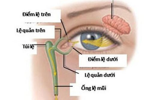 Điều trị viêm túi lệ kéo dài