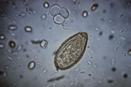 6 cảnh báo khi nhiễm sán lá gan