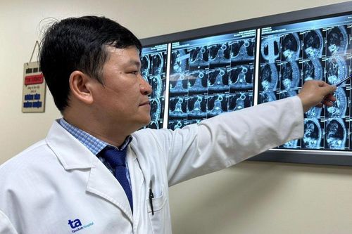 Phát hiện u tủy sống sau 4 tháng yếu liệt
