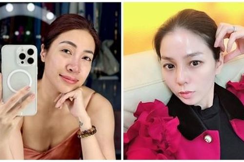Trước Pha Lê, nhiều sao Việt bị biến chứng sau sửa mũi