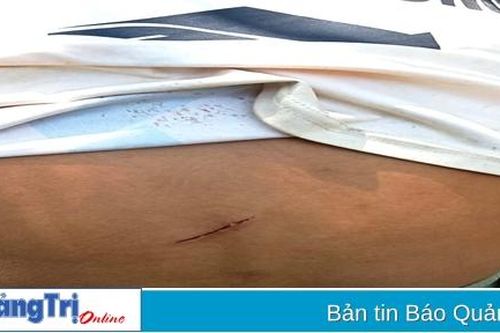 Hướng Hóa: Voọc gáy trắng tấn công khiến người dân bị thương