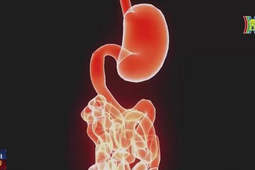 Ung thư đường tiêu hóa đang ngày càng trẻ hóa