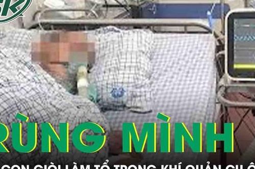 30 con giòi làm tổ trong khí quản cụ ông