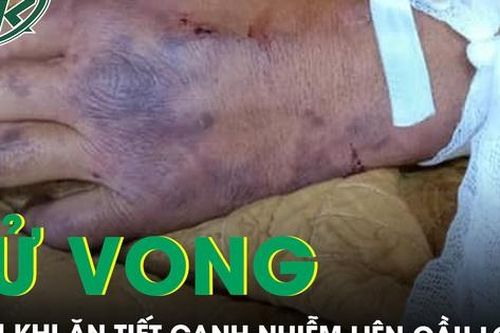 Một người tử vong sau khi ăn tiết canh lợn