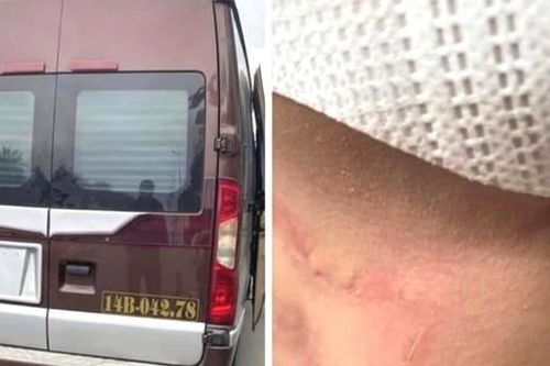 Thông tin mới nhất vụ nữ hành khách tố nhà xe bóp cổ, bỏ mặc giữa cao tốc