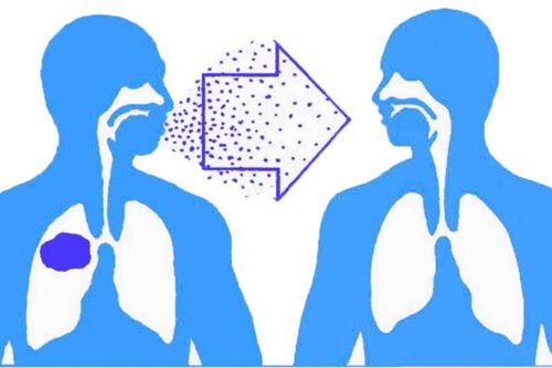 Bảo đảm tiếp cận toàn diện trong chăm sóc và nghiên cứu về bệnh lao