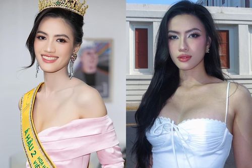Nhan sắc của Á hậu Minh Nhàn sau khi 'dao kéo'