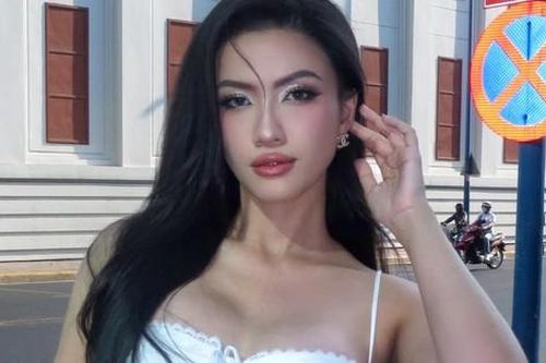 Á hậu Minh Nhàn khác lạ không nhận ra sau khi công khai phẫu thuật thẩm mỹ