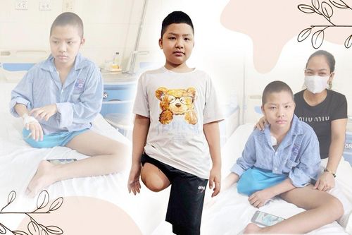 Ước mơ được lắp chân giả của cậu bé ung thư xương