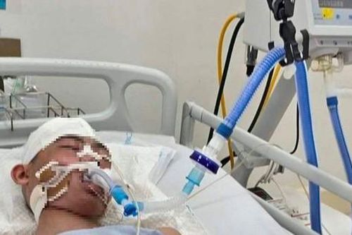 Điều tra vụ học sinh lớp 8 ở Long Biên bị đánh nguy kịch khi chơi bóng rổ