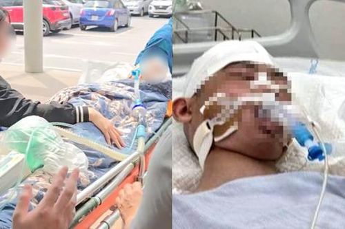 Nam sinh lớp 8 ở Hà Nội bị hành hung đến chấn thương sọ não khi chơi bóng rổ