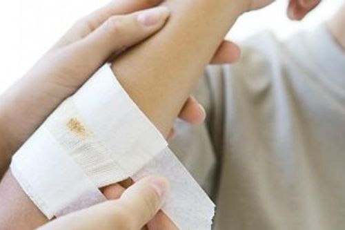 Chữa trị cho trẻ tự gây vết thương