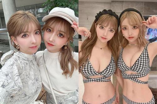Cặp sinh đôi 'dao kéo' cả gương mặt để giống nhau giờ ra sao