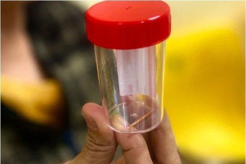 Tin tức Đời sống 26/3: Thủng dạ dày vì thói quen nhiều người hay mắc