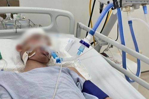 Vụ nam sinh lớp 8 bị đánh chấn thương sọ não: Gia đình xác định mất con, đưa về quê chuẩn bị hậu sự