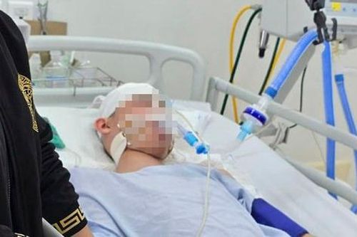 Từ vụ việc nam sinh lớp 8 ở Hà Nội bị đánh dã man: Chết não có khả năng hồi phục hay không?