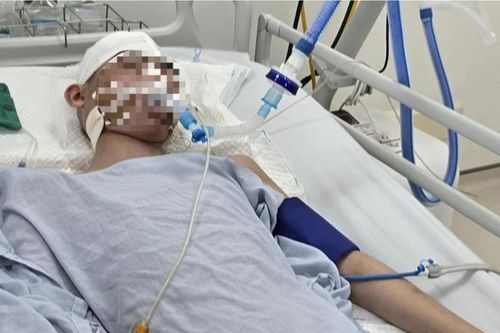 Nam sinh lớp 8 bị đánh chết não: Kẻ ra tay man rợ có bị xử lý tội giết người?