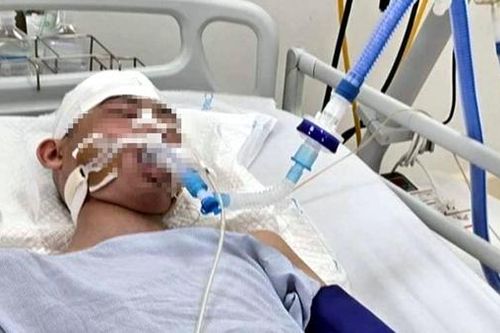 Vụ nam sinh lớp 8 bị đánh chết não: Công an đang điều tra có đồng phạm hay không