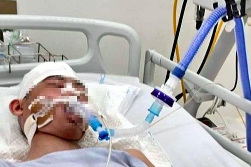 Diễn biến mới tình hình sức khỏe nam sinh lớp 8 bị đánh chấn thương sọ não